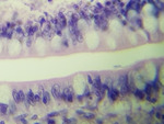MISSING THUMBNAIL
